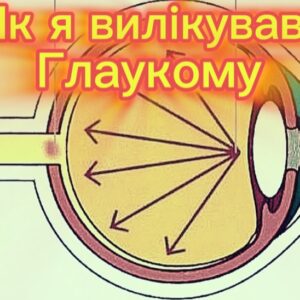 Як я вилікував глаукому